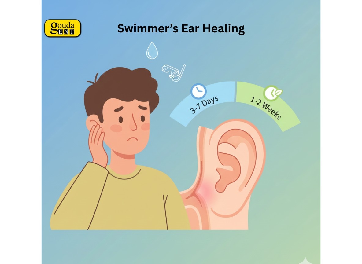 Infographic of swimmer’s ear (otitis externa) showing ear inflammation and healing time from days to weeks