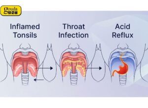 Pain in Throat While Swallowing?